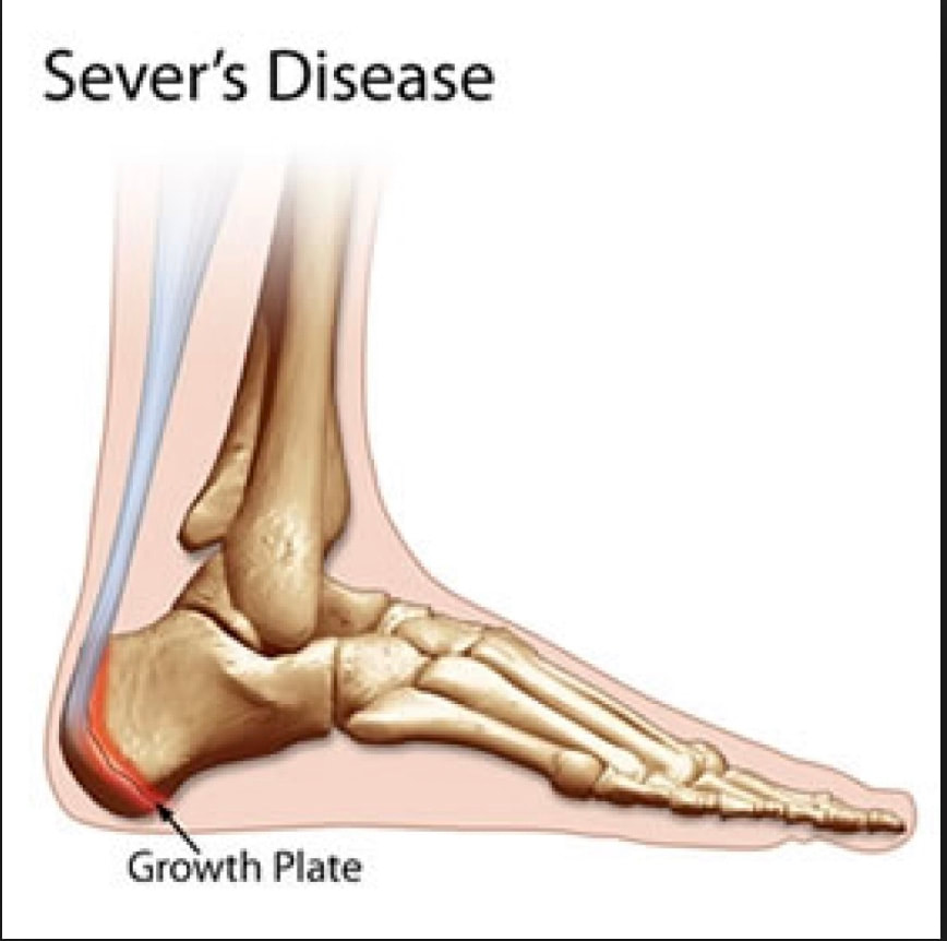 painful heel bone